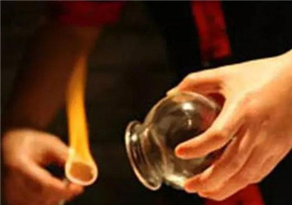 關(guān)節(jié)炎可以拔火罐嗎？關(guān)節(jié)炎拔罐管用嗎？