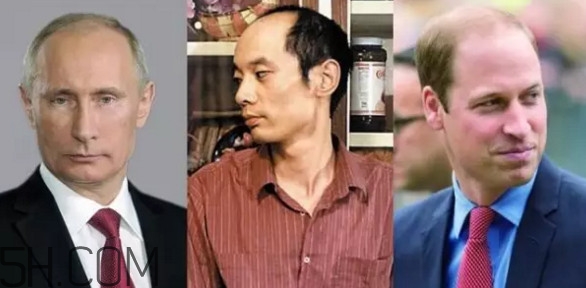 為什么會禿頂？禿頂的人聰明嗎