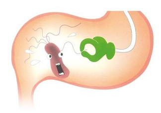 幽門螺桿菌會傳染嗎？幽門螺桿菌吃什么藥