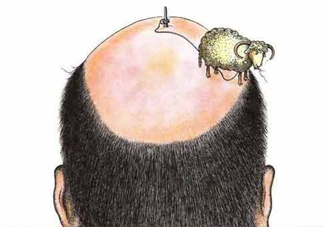 禿頂了還能長(zhǎng)出頭發(fā)嗎？禿頂和性欲太強(qiáng)是不是有關(guān)