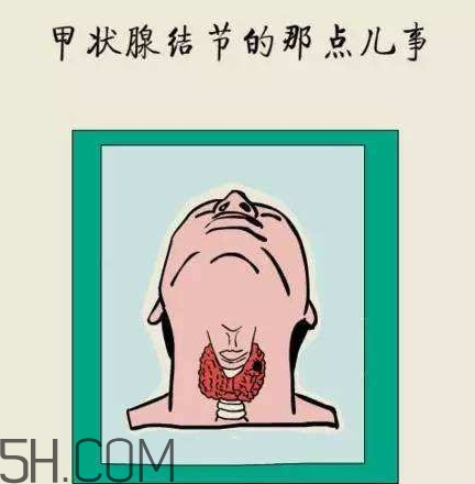 為什么會(huì)得甲狀腺結(jié)節(jié)？甲狀腺節(jié)結(jié)是什么？
