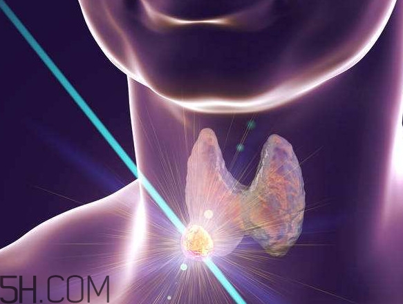 什么樣的甲狀腺結(jié)節(jié)要懷疑是癌？甲狀腺結(jié)節(jié)嚴(yán)重嗎