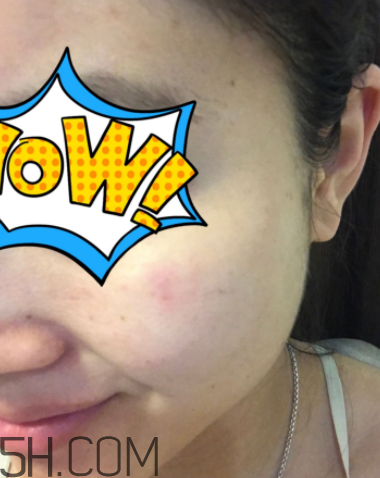 菲洛嘉21天美白精華多少錢_專柜價格 菲洛嘉21天美白精華多少錢_專柜價格