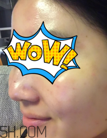 菲洛嘉21天美白精華多少錢_專柜價格 菲洛嘉21天美白精華多少錢_專柜價格