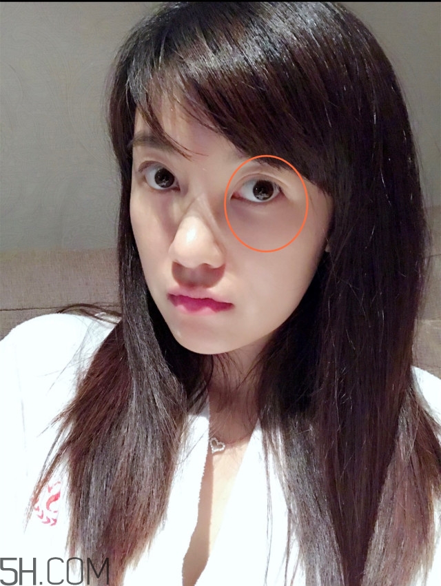 黑眼圈怎么去除既簡單有容易 看類型與程度 黑眼圈怎么去除既簡單有容易 看類型與程度