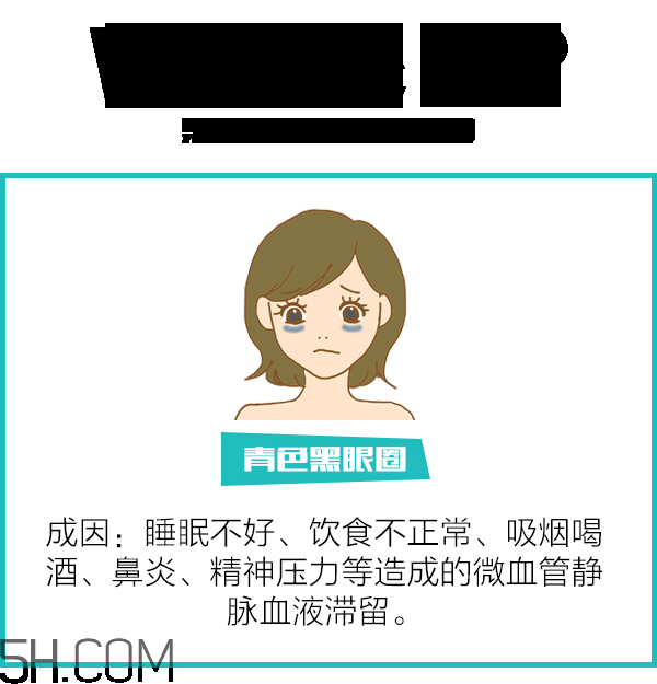 黑眼圈怎么去除既簡單有容易 看類型與程度 黑眼圈怎么去除既簡單有容易 看類型與程度