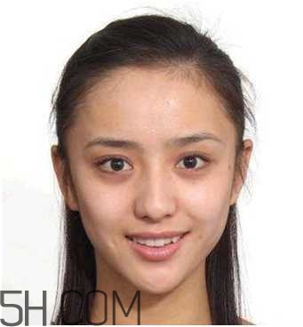 黑眼圈怎么去除既簡單有容易 看類型與程度 黑眼圈怎么去除既簡單有容易 看類型與程度