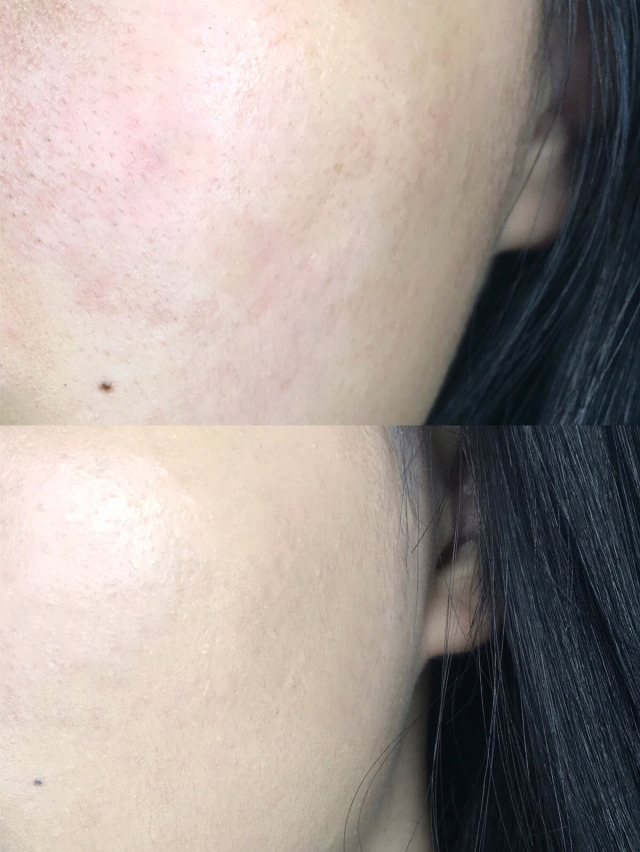 如何選擇適合自己的粉底液 膚質(zhì)膚色及妝效很重要 如何選擇適合自己的粉底液 膚質(zhì)膚色及妝效很重要