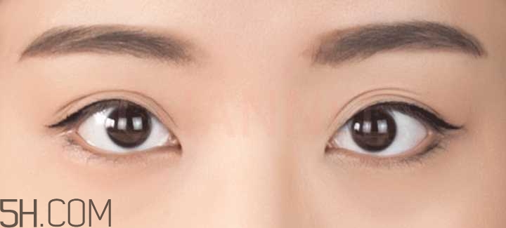 黑眼圈怎么去除既簡單有容易 看類型與程度 黑眼圈怎么去除既簡單有容易 看類型與程度