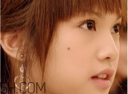 痣是怎么形成的？女人痣長(zhǎng)哪里最有福氣