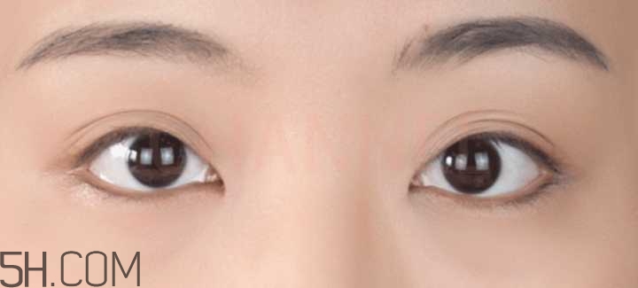 黑眼圈怎么去除既簡單有容易 看類型與程度 黑眼圈怎么去除既簡單有容易 看類型與程度