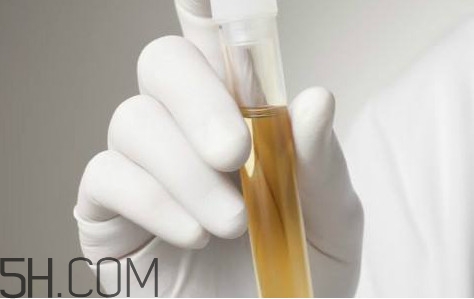 尿毒癥怎么預防？尿毒癥可以同房嗎