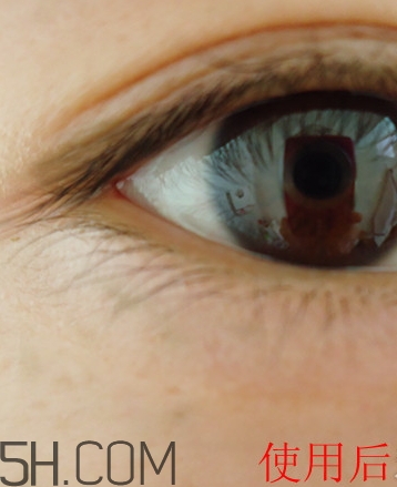 透真眼霜適合什么年齡段？透真眼霜多少錢