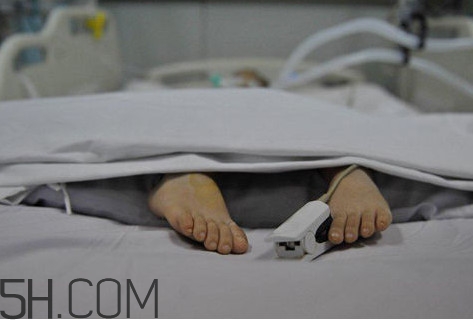 腦死亡是什么意思？腦死亡判定有嚴(yán)格標(biāo)準(zhǔn)