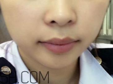 小蜜蜂細致修護唇膏很油嗎？夏天用合適嗎？