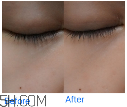 小蜜蜂水洗面膜怎么樣？小蜜蜂水洗面膜好用嗎？