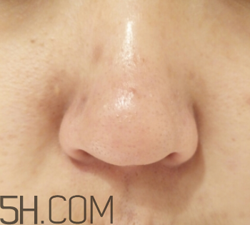 御泥坊鼻膜怎么樣？御泥坊鼻膜好用嗎？