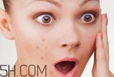 卸妝油適合痘痘肌膚嗎？植村秀卸妝油哪款最好用？