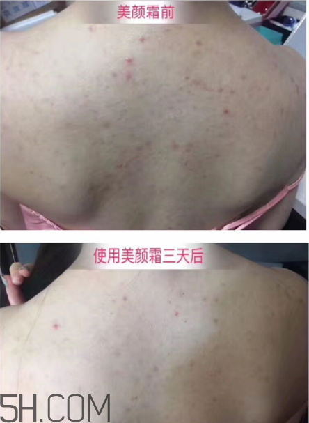 伊妮娜美顏霜有激素嗎 伊妮娜美顏霜有依賴嗎 伊妮娜美顏霜有激素嗎 伊妮娜美顏霜有依賴嗎