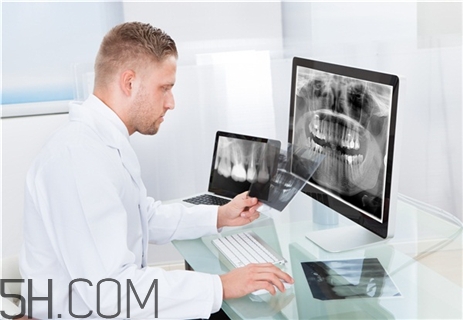 骨折要打石膏嗎？骨折要花費多少錢？