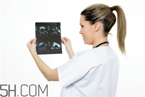 骨折會(huì)影響月經(jīng)嗎？骨折對(duì)性功能有影響嗎？