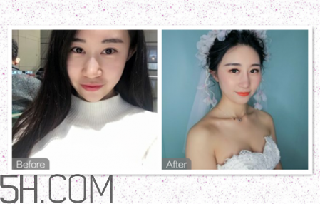 鼻頭縮小術(shù)過程圖 鼻頭縮小手術(shù)千萬別做后悔死