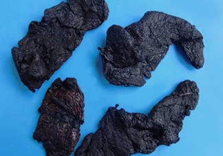 熟地黃是什么？熟地黃有什么功效？