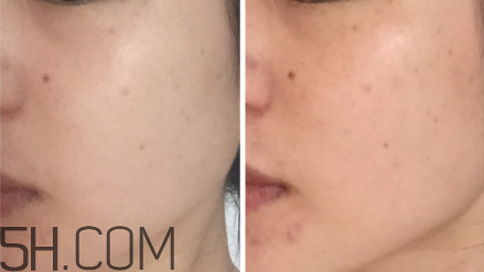 科顏氏淡斑精華液有用嗎？科顏氏淡斑精華液使用心得