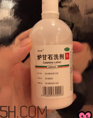 爐甘石洗劑是洗還是擦？爐甘石洗劑是什么顏色？