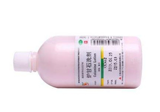 爐甘石洗劑能治痘痘嗎？爐甘石洗劑能治皰疹嗎？