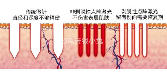 11款網紅美容儀器排行榜2018 是噱頭還是真本事