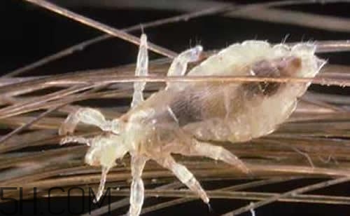 孩子長虱子是怎么回事？孩子長虱子該怎么辦？