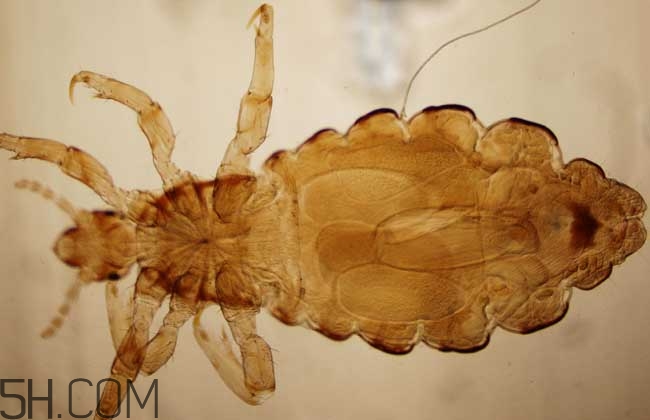 孩子長虱子是怎么回事？孩子長虱子該怎么辦？