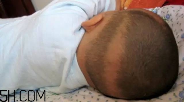 寶寶枕禿怎么辦？如何改善寶寶枕禿現(xiàn)象？