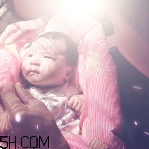 寶寶枕禿怎么辦？如何改善寶寶枕禿現(xiàn)象？