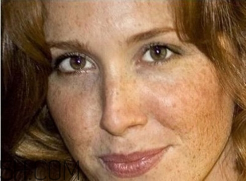 血瘀體質(zhì)容易長色斑嗎？有血瘀體質(zhì)的人如何去除色斑呢？