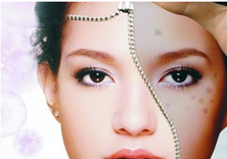 血瘀體質(zhì)容易長色斑嗎？有血瘀體質(zhì)的人如何去除色斑呢？