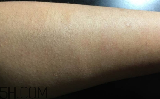 千纖草卸妝水有激素嗎？千纖草卸妝水曝光