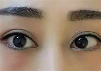 怎么紋美瞳線好看？紋美瞳線的危害