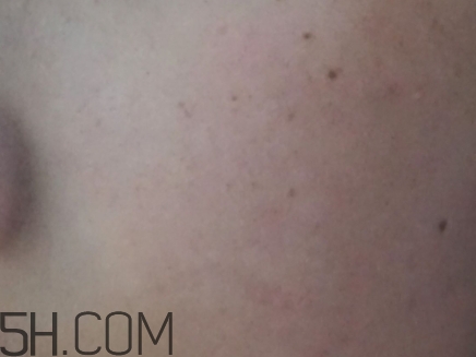 724高保濕面霜是什么？724高保濕面霜好用嗎？