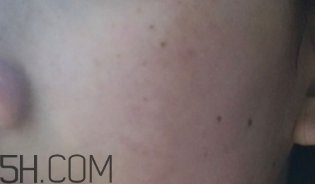 724高保濕面霜是什么？724高保濕面霜好用嗎？