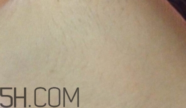 豬油膏要卸妝嗎？豬油膏怎么卸妝？