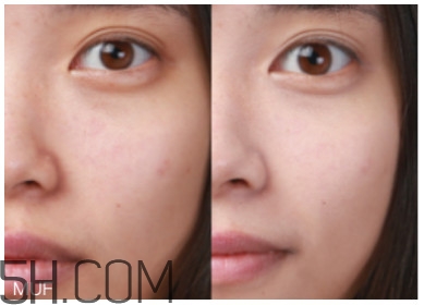 冬天干皮用什么粉底液 冬季干皮粉底液推薦 冬天干皮用什么粉底液 冬季干皮粉底液推薦