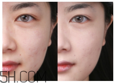 冬天干皮用什么粉底液 冬季干皮粉底液推薦 冬天干皮用什么粉底液 冬季干皮粉底液推薦