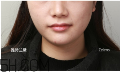 冬天干皮用什么粉底液 冬季干皮粉底液推薦 冬天干皮用什么粉底液 冬季干皮粉底液推薦