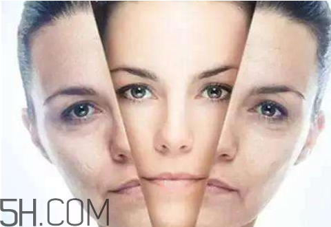 貝洛娜水光針騙局 貝洛娜水光針真假辨別 貝洛娜水光針騙局 貝洛娜水光針真假辨別