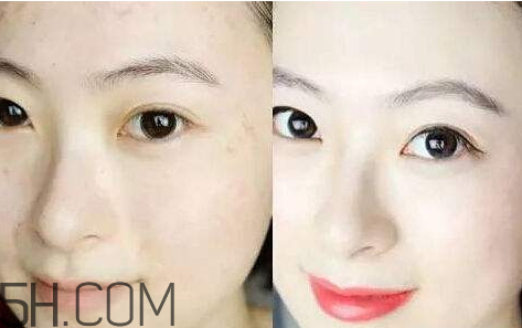 貝洛娜水光針騙局 貝洛娜水光針真假辨別 貝洛娜水光針騙局 貝洛娜水光針真假辨別