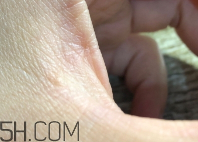 雅頓金膠適合什么膚質(zhì)？雅頓金膠適合油皮和混油皮嗎？