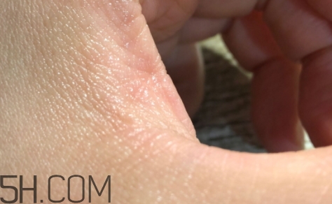 雅頓金膠適合什么膚質(zhì)？雅頓金膠適合油皮和混油皮嗎？