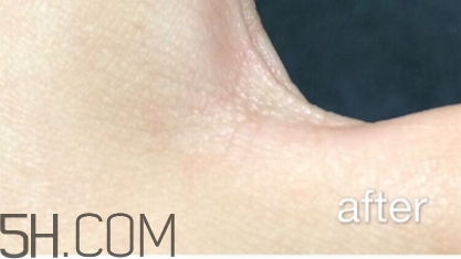 雅頓小銀蛋是什么？雅頓小銀蛋多少錢？